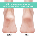 Anti Crack Silicon Gel Heel Moisturizing Socks for Foot Care Men Women (Loose Pack)