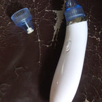 2-in-1 Blackhead Extractor – Multi-Color Vacuum Pore Cleaner (Batteries-Free)